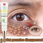 Crème pour les yeux dissolvant de granulés de graisse