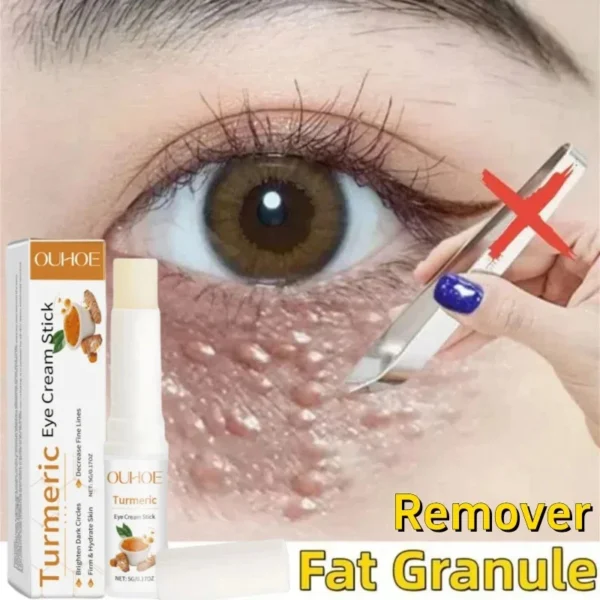 Dissolvant De Granulés De Graisse Oculaire