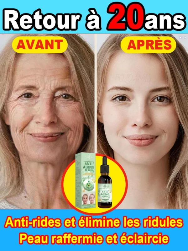 Les Rides Disparaissent, Le Premier Choix De Beauté – Image 2