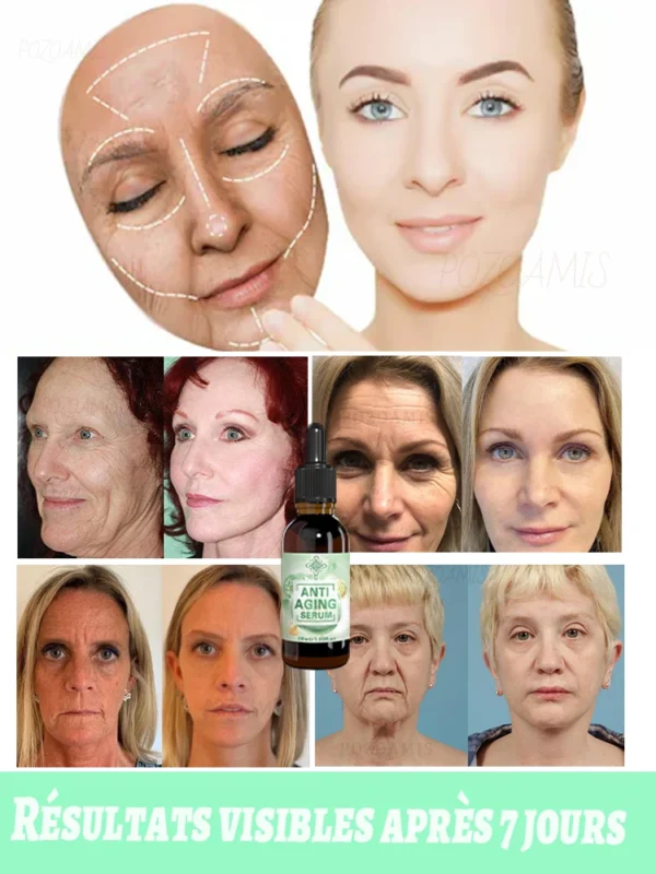 Les Rides Disparaissent, Le Premier Choix De Beauté – Image 4