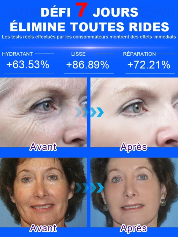 Les Rides Disparaissent, Le Premier Choix De Beauté – Image 3