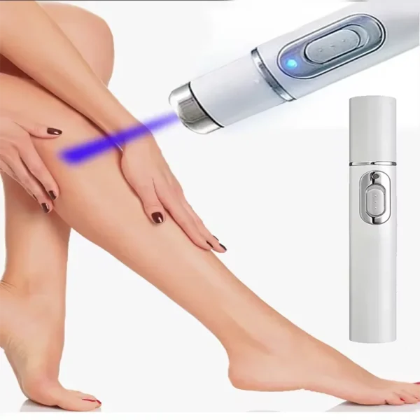 Soulagement De La Vascularite Dilatée Dans La Phlébite Des Jambes