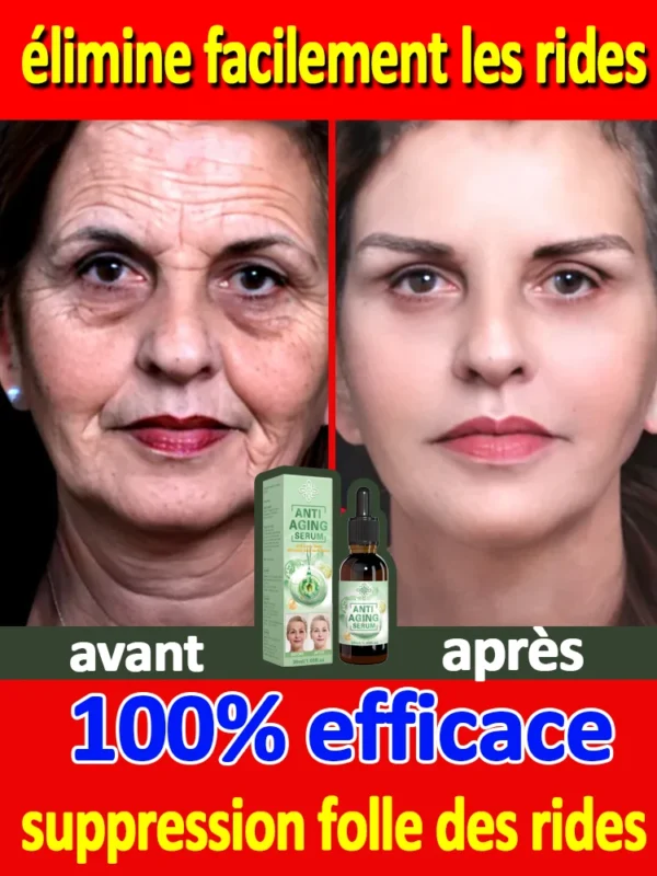 Les Rides Disparaissent, Le Premier Choix De Beauté