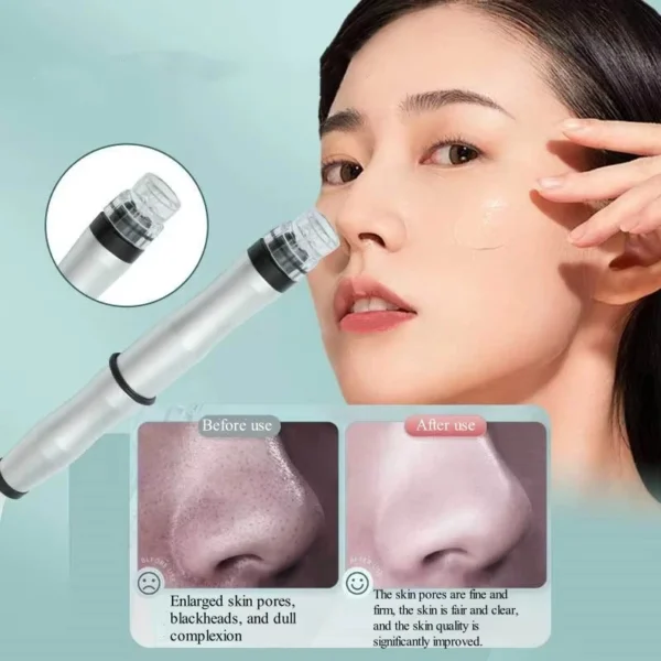 Nettoyeur De Beauté Pour Le Visage – Image 4
