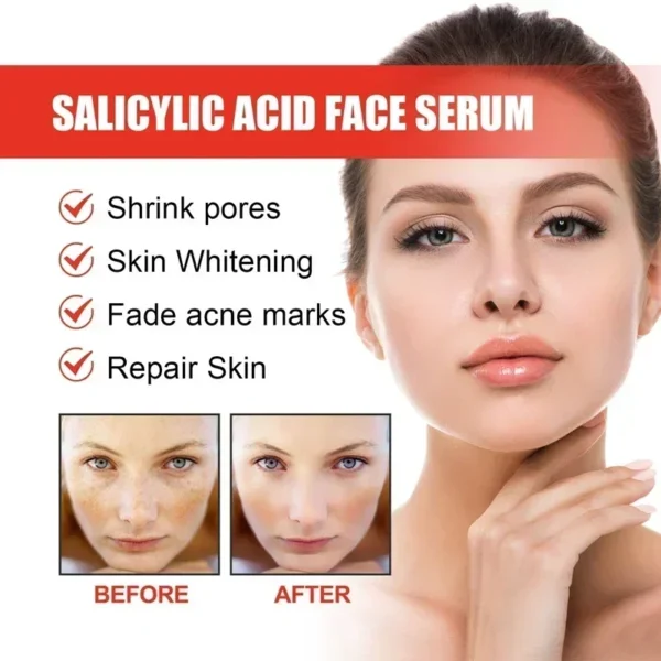 Sérum Pour Le Visage Niacinamide – Image 5